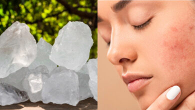 Alum For Pigmentation